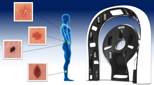 🧬 AI Skin Cancer Detection Challenge